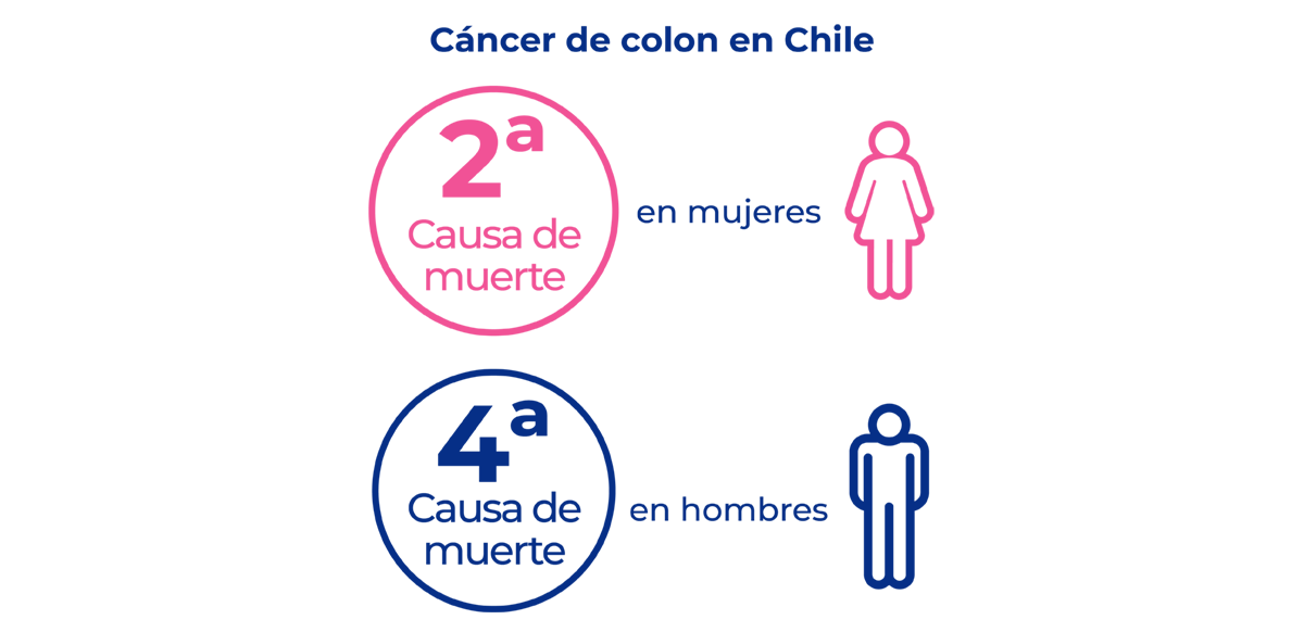 Estadísticas sobre cáncer de cólon