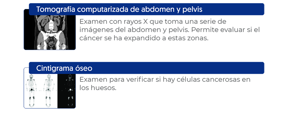 Tomografía computarizada, Cintigrama óseo