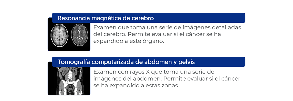 Etapificación, resonancia magnética de cerebro, tomografía computarizada