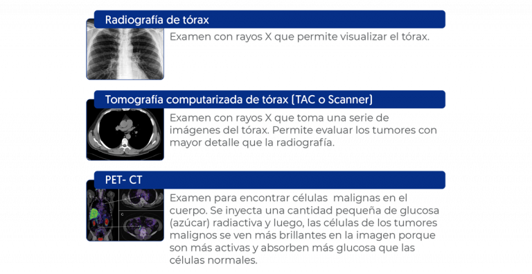 Evaluación con imágenes, radiografía de tórax, tomografía computarizada, PET-Ct