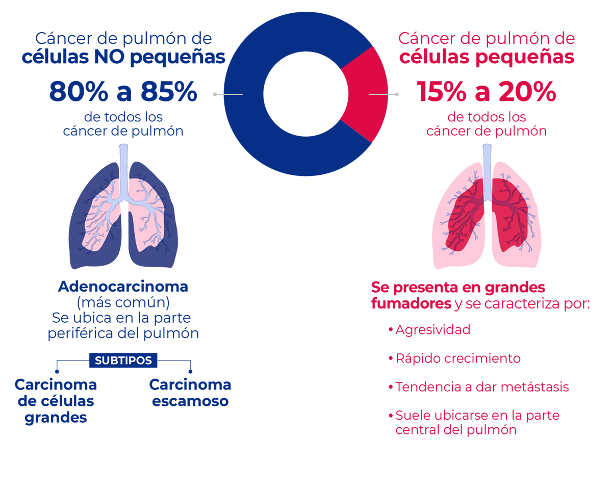 Tipo de cáncer de pulón, células no pequeñas de 85%, células pequeñas 15%