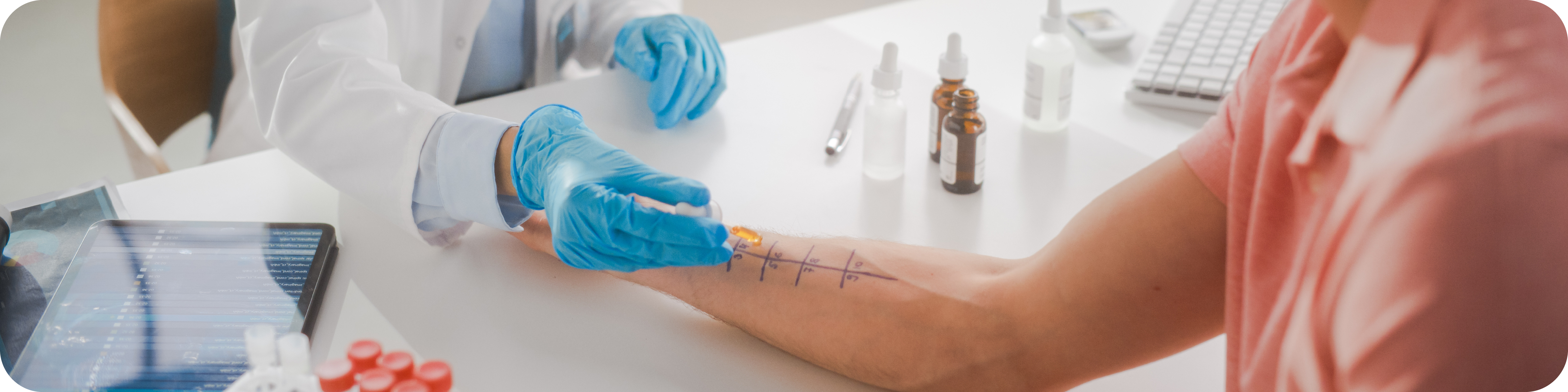 Profesionar realizando un test de alergia en brazo