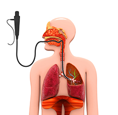 Broncoscopía diagnóstica y terapéutica