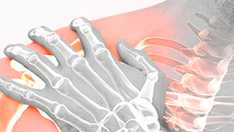 Fractura de húmero proximal