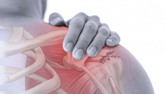 Lesiones asociadas al manguito rotador