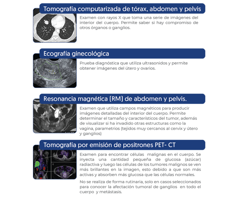Evaluación con imágenes Tac, Ecografía, Resonancia Magnética, PET-CT