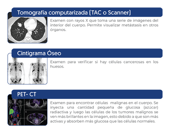 Etapificación, imagenología, tomografía computarizada, cintigrama Ósea, PET-CT