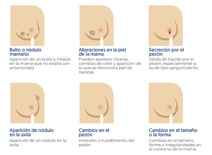 Síntomas, bulto o nódulo mamario, alteraciones en la piel, secreciones por el pezón, nódulo axilar, cambios en el pezón, cambio en el tamaño o forma de la mama