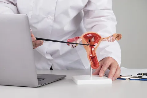 Cirugia Laparoscopica