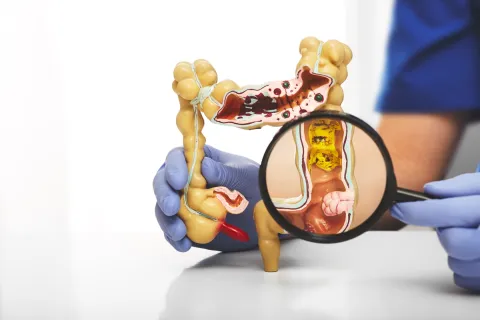 Coloproctología