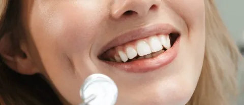 Implantes Dentales