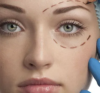 Rostro de mujer preparado para cirugía plástica