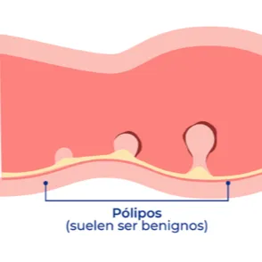 Pólipos