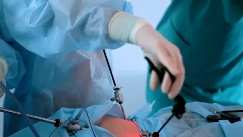 Colecistectomía laparoscópica