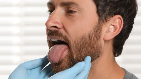 Cirugía de amígdalas