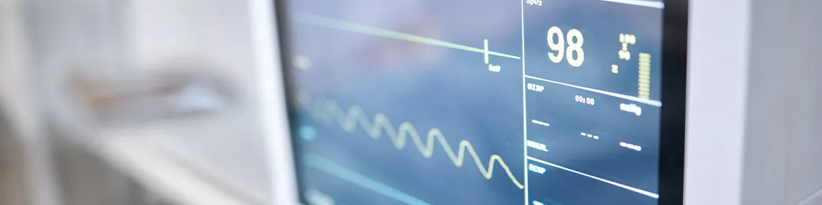 unidad del paciente crítico cardiovascular