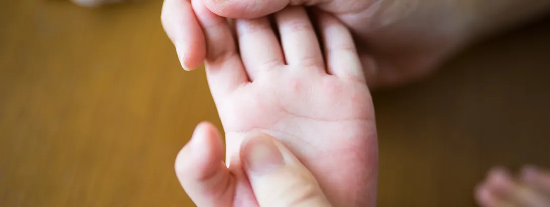 Servicio de Pediatría