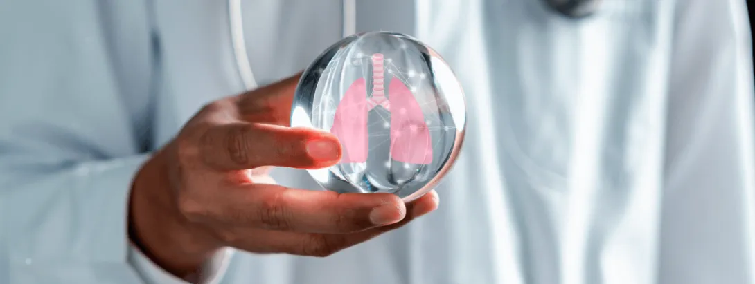 Nuevas estrategias para el manejo del cáncer pulmonar