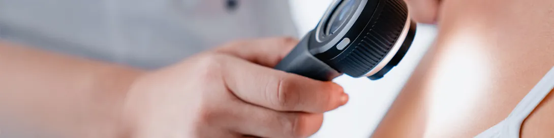 Doctora examinando a paciente. Especialidad Dermatología