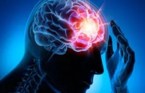 Accidentes Cerebrovasculares: La clave está en la detección y prevención