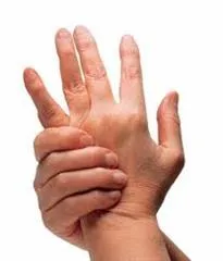 Artritis Reumatoide: Un Inesperado y Doloroso Mal