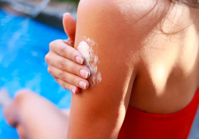 Insolación y quemaduras: ¿Cómo evitarlas?