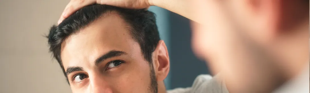Caída de pelo