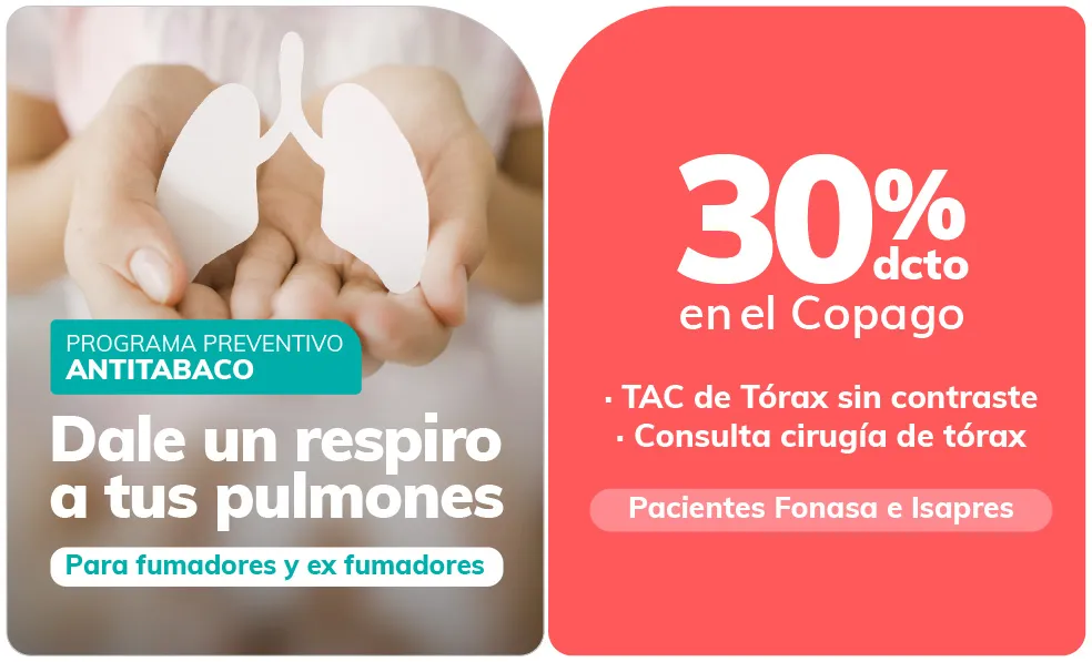 Anti Tabaco