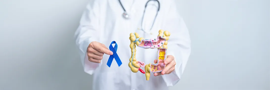 Preventivo Cáncer de Colon