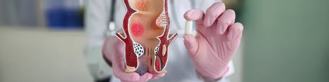 Cirugía Coloproctologica