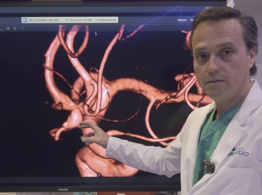 Únicos en la Región del Biobío: cirugía de aneurisma cerebral no roto se incorpora a la cobertura del Bono PAD